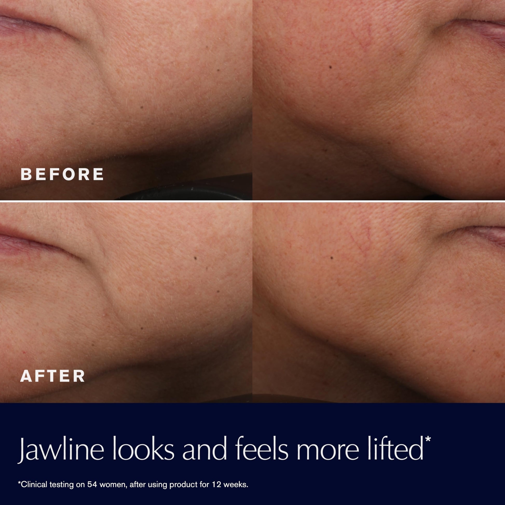 Estée Lauder Revitalizing Supreme+ hibiscus extract signals firmer look